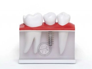 ����������� ������� ��������������