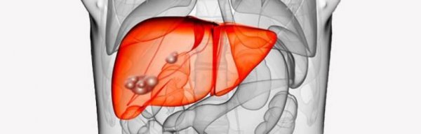 ����� ������: ����������������� �������� ��������