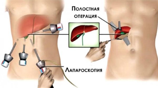 ����� ������: ����������������� �������� ��������