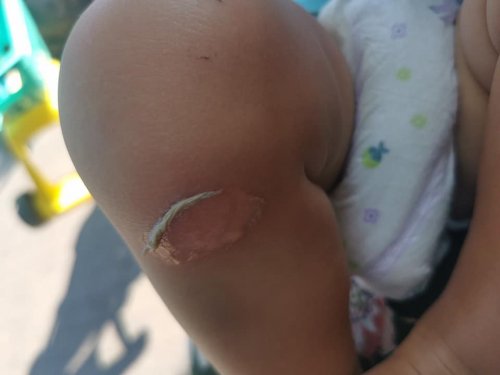 � ������ ������� ������� ����� ��-�� ���������� ����������: ������ ������� "������"